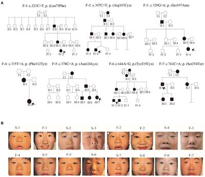 Functional Studies of Novel FOXL2 Variants in Chinese Families With Blepharophimosis–Ptosis–Epicanthus Inversus Syndrome